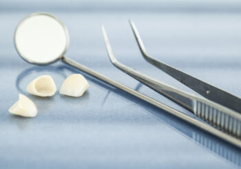 dental veneers - Elements Dental Spa & Aesthetics