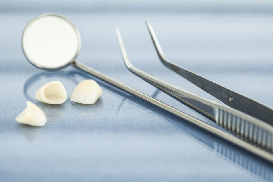 dental veneers - Elements Dental Spa & Aesthetics