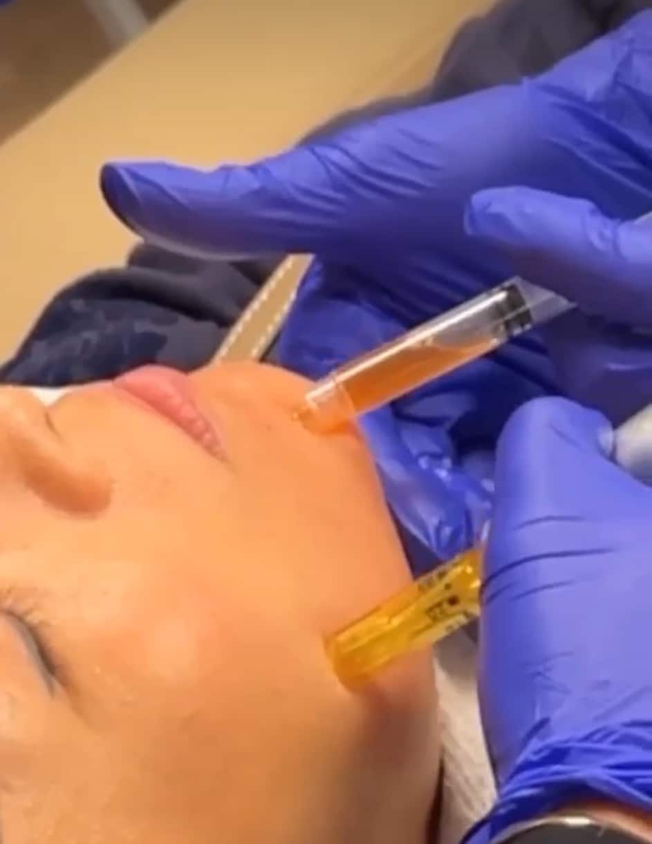 a person relaxes as they receive facial injections