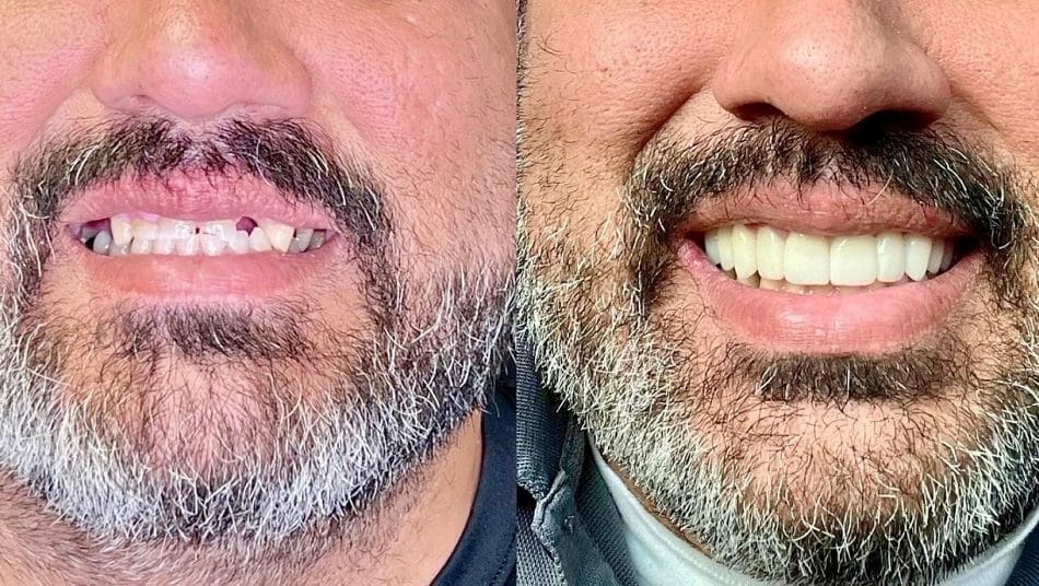 Close-up comparison of a man