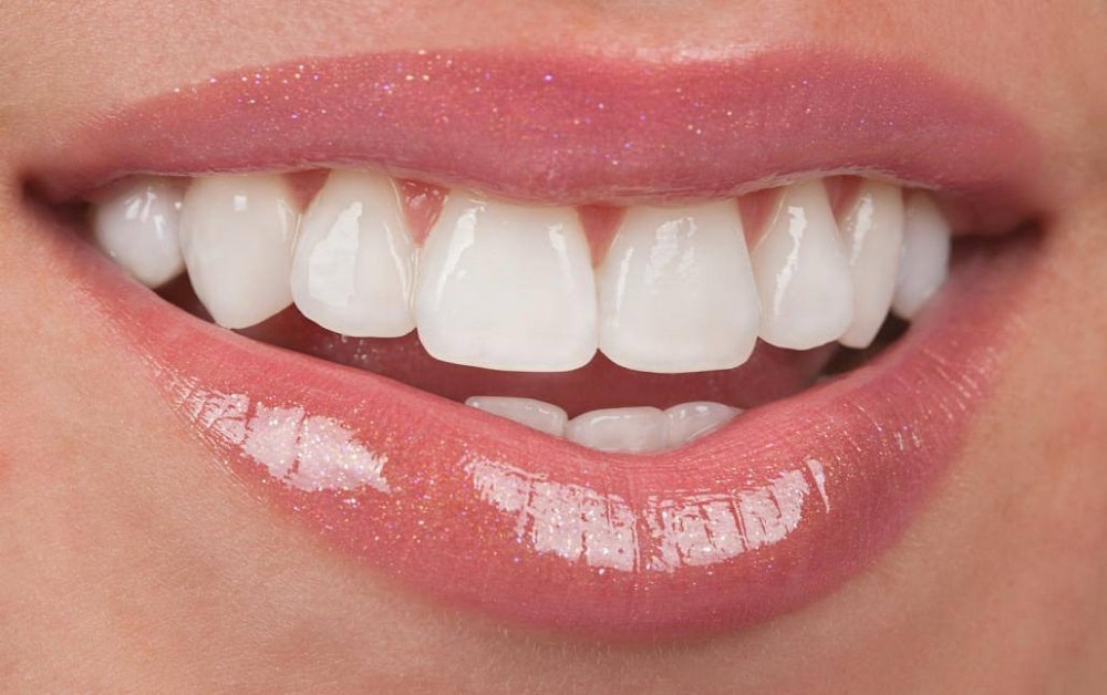 Close-up of a person's mouth showing a smile with white teeth and glossy pink lips.